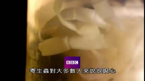 主動感染！與寄生蟲共舞