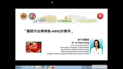 腹腔內治療策略-HIPEC的應用