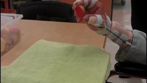 戴tenodesis splint.mp4