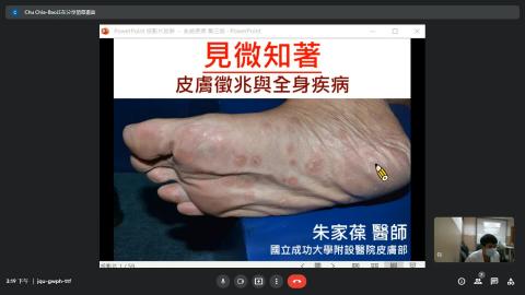 系統性疾病之皮膚表現(Systemic disease-related skin presentation)