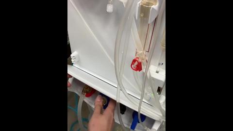 血液灌流HP-面板設定