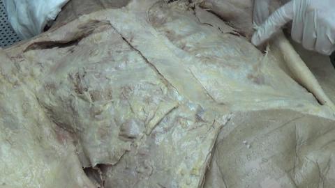 930 第一組 Pectoral After.MP4