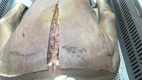 930 第二組 Scapular After.MTS