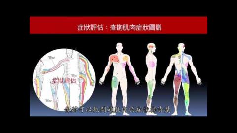 日常疼痛控制-陳文玲 老師 (精華版) -[成大磨課師moocs]