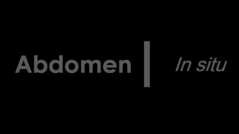 1101 第一組 Abdomen in situ #2.MP4