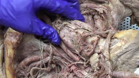 1216 第五組 Neck II Deep structure After #2.MP4