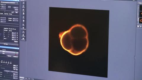 共軛焦螢光顯微鏡技術原理-實作3