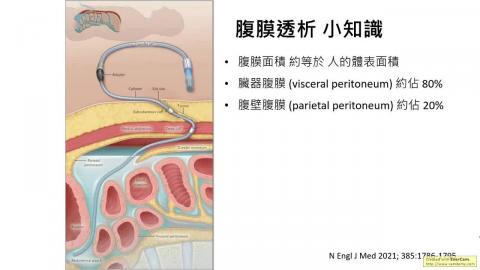 2022.03.15腹膜透析簡介-趙若雁醫師