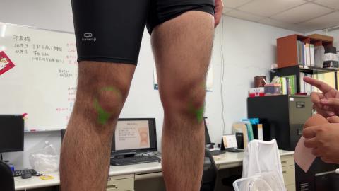 髕股肌腱炎 貼紮.mp4