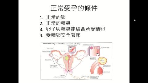 吳孟興醫師_ART part 2.mp4