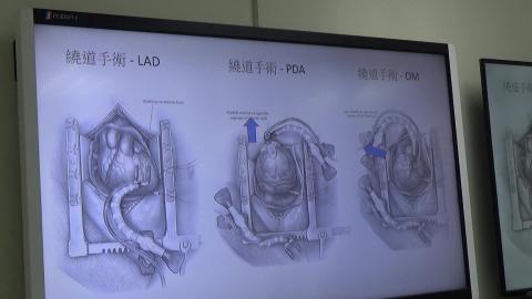 1215 心臟實作(V).MP4