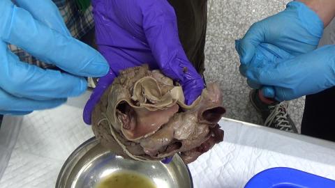 1215 心臟實作(VI).MP4