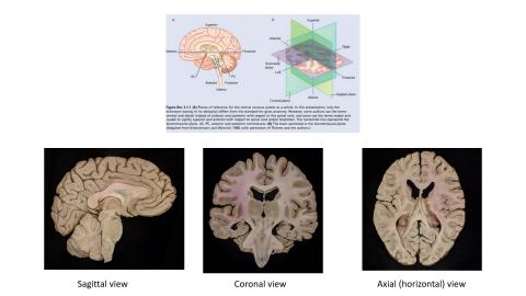 20230306 Neuroanatomy.mp4