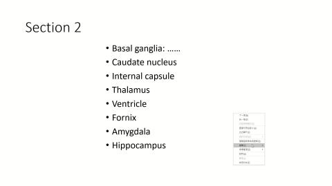 【Online】Neuroanatomy Lab 2.mp4