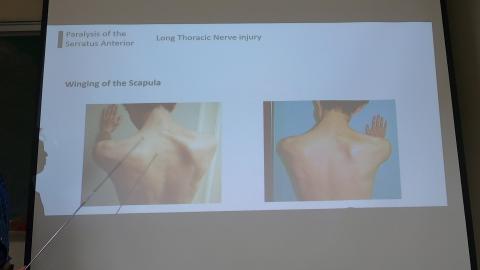 Pectoral and scapular-4.MP4