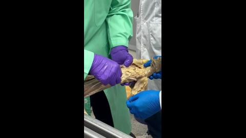 Upper limb Demo 2.MOV