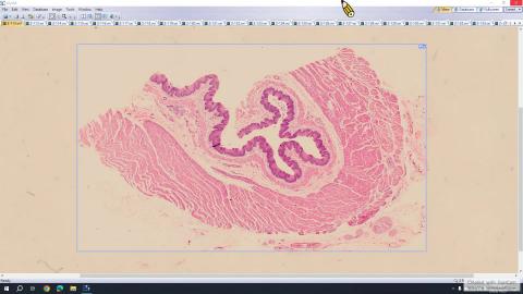 20231027 Histology Demo－GI.mp4