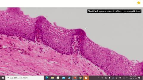 Histology Female reproductive system III-Placenta.mp4
