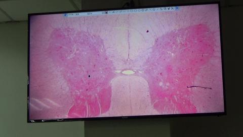 20231205 Histology CNS demo - spinal cord.MP4