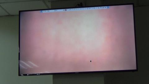 20231205 Histology CNS demo - Pons.MP4