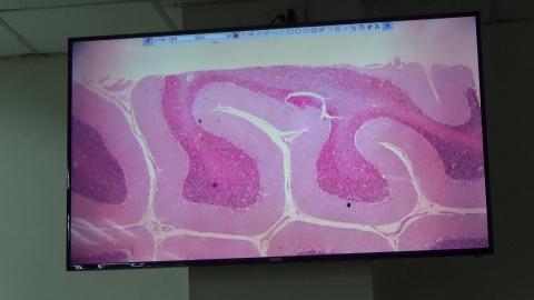 20231205 Histology CNS demo - Cerebellum.MP4