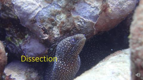 4.1. Anterior, Superior, posterior Mediastinum and ANS dissection-video.mp4