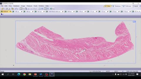 2024 Cardiovascular system Demo-1.mp4