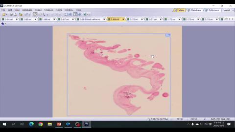 2024 Cardiovascular system Demo-2.mp4