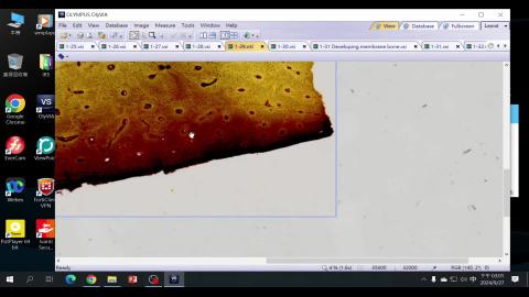 2024 Cartilage & Bone Demo-2.mp4