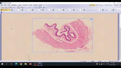 2024 Digestive system II Demo-1.mp4