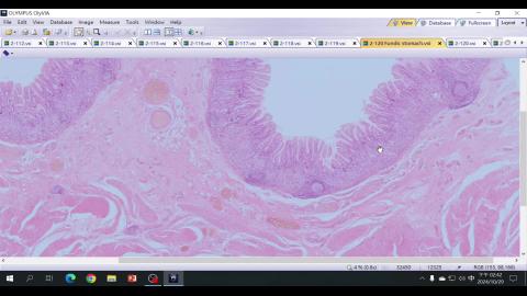 2024 Digestive system II Demo-2.mp4