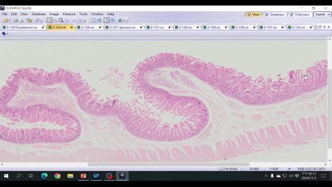 2024 Digestive system II Demo-3.mp4