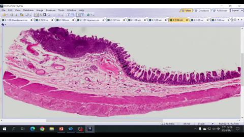 2024 Digestive system II Demo-4.mp4
