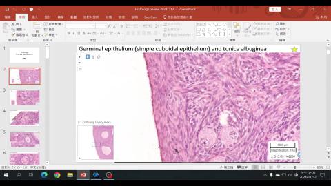 2024 Review Female reproductive system-1.mp4