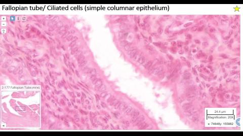2024 Review Female reproductive system-2.mp4