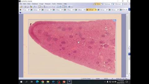 2023 Lymphatic system Demo-2.mp4