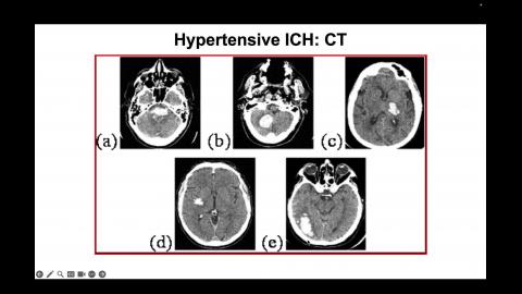 (70558)WBC-宋碧姍-5.mov