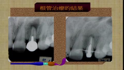 醫學與健康_張金石_陳育堂_楊宜杰_2020_03_23(下)