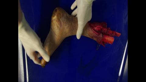 組織檢體教學病肢簡介