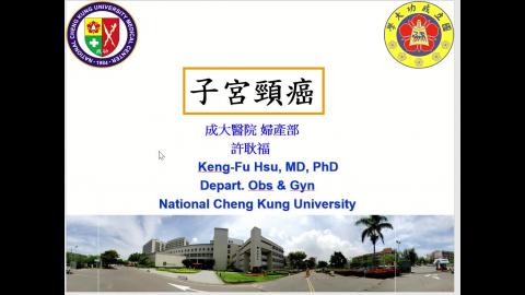 Dr 許耿福 子宮頸癌.mp4